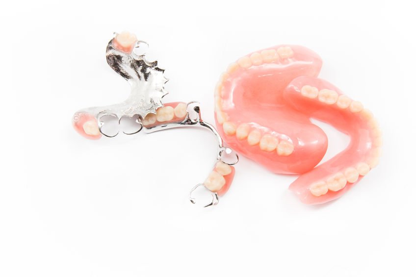 dentures - partials