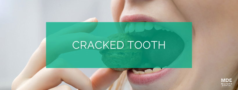 cracked tooth